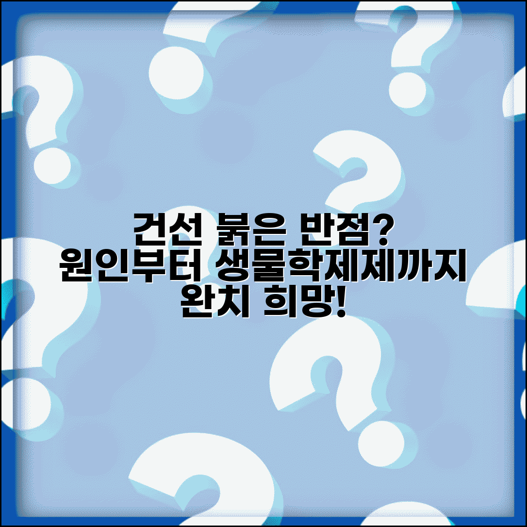 건선 증상 원인 치료 생물학제제 | 건선 붉은 반점 각질